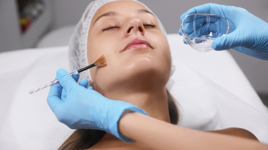 Chemical Peels Gold Coast