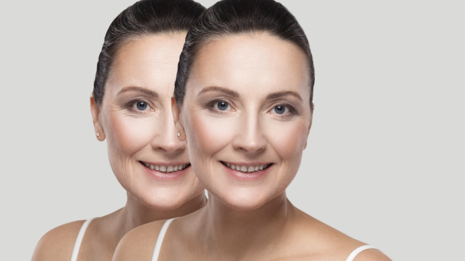 The Power of Cosmetic Injections