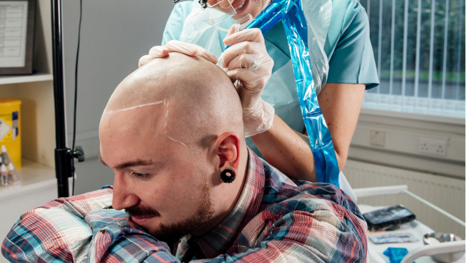 Scalp Tattooing Gold Coast